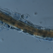 An electron microscope image of mycorrhizal fungi